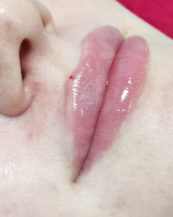 Косметолог | Київ, Позняки