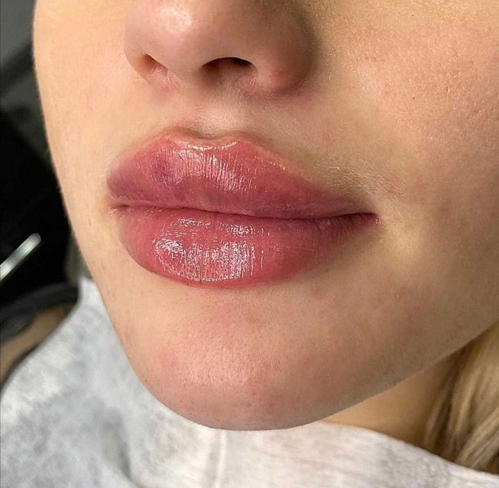 Акция! -30%!Увеличение губ в технике плоский бант.