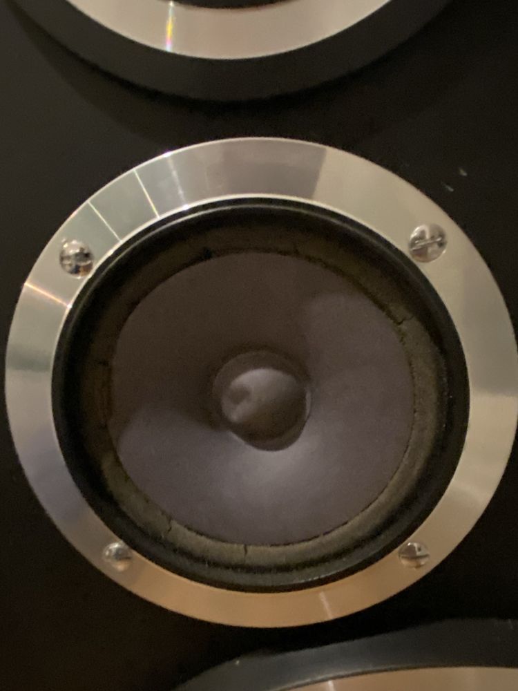 Tonsil altus 75 1983