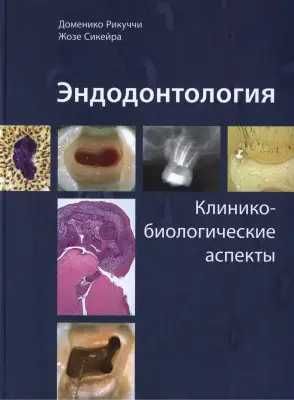 Эндодонтология‼️ Клинико-биологические аспекты, Рикуччи стоматология