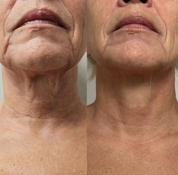 Косметолог мед образование. эпиляция. шугаринг. татуаж. ламинирование