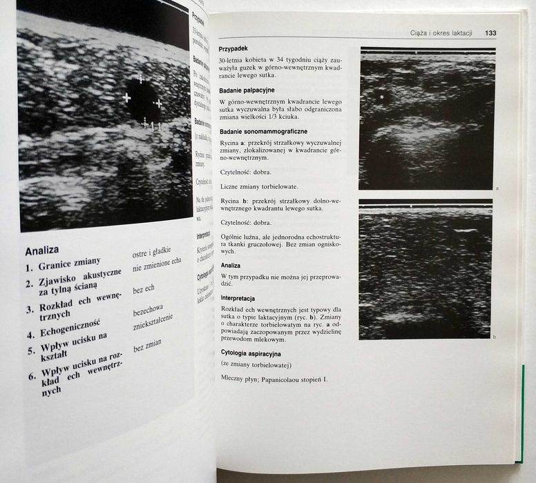 Atlas ultrasonograficzny sutka, Leucht, Madjar, UNIKAT!