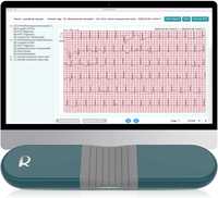 ЕКГ-монітор Wellue,  пристрій відстеження стану серця