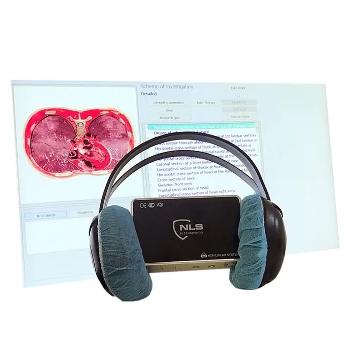 Máquina de Biorressonância 9D NLS – Diagnóstico e Terapia com Alta Tec