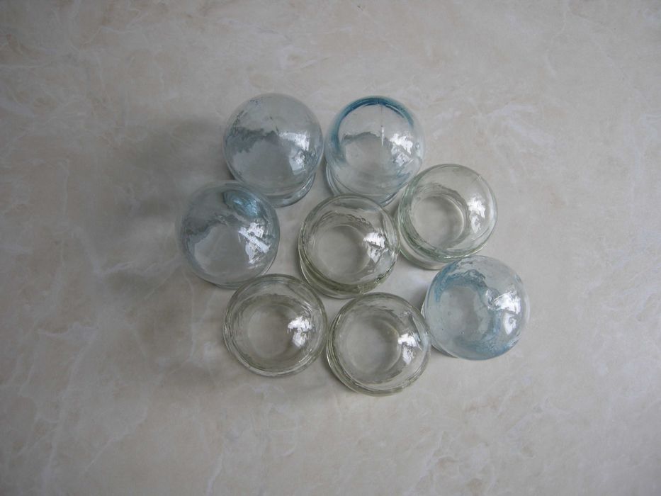 Медицинские стеклянные банки для вакуумного массажа, СССР