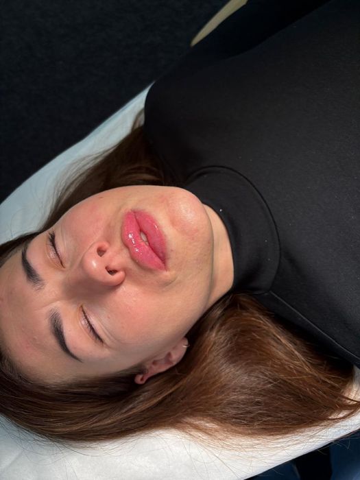 Пошук моделей на губи та ботокс