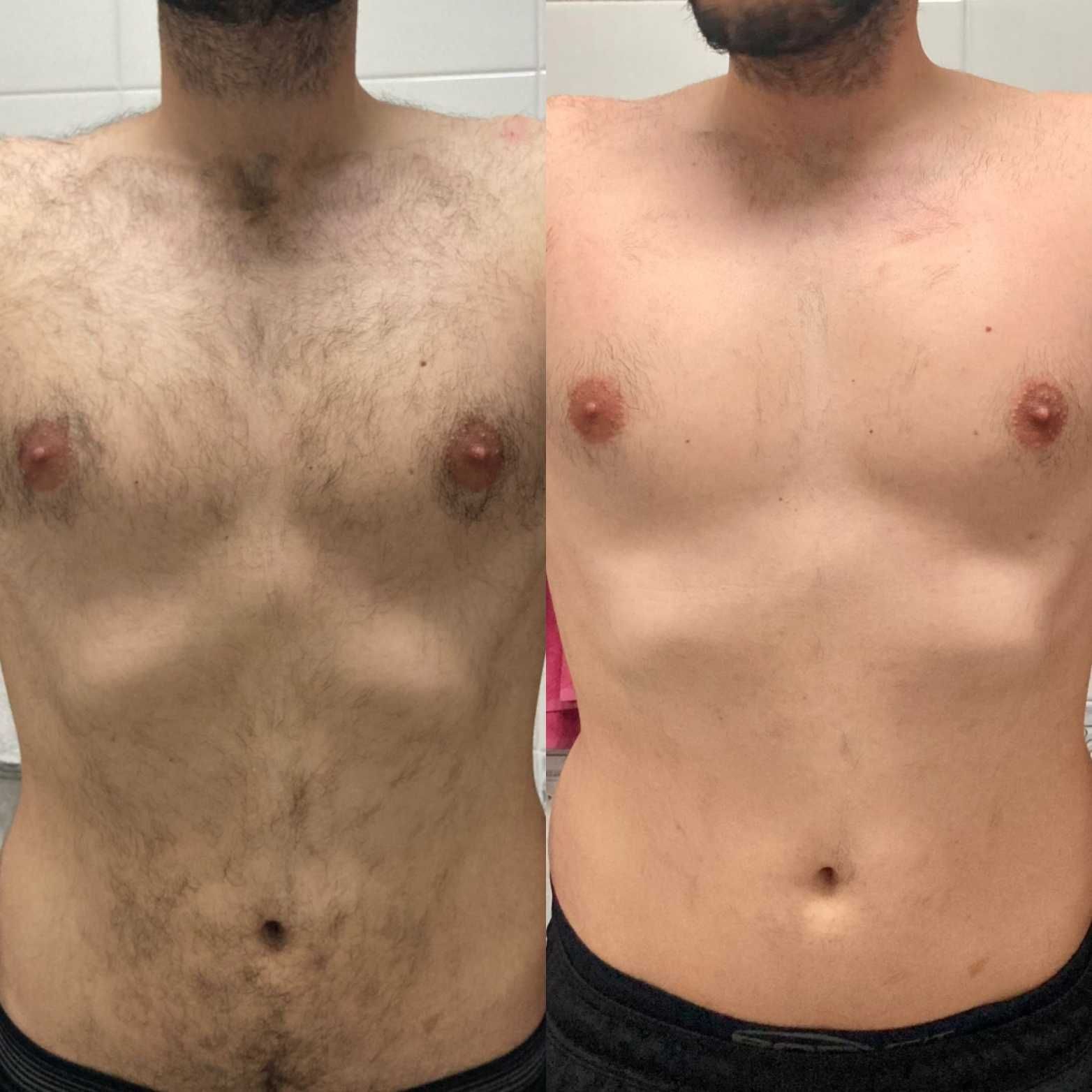 Estética, massagens e depilação a laser