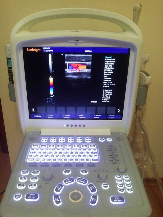 Оренда УЗД ( УЗИ ) апарата з доплером, чотирі датчики, візок