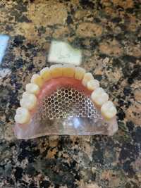 Naprawa protez zębowych