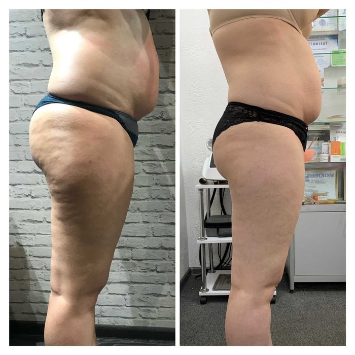 Масаж/Депіляція воском/Апаратний масаж