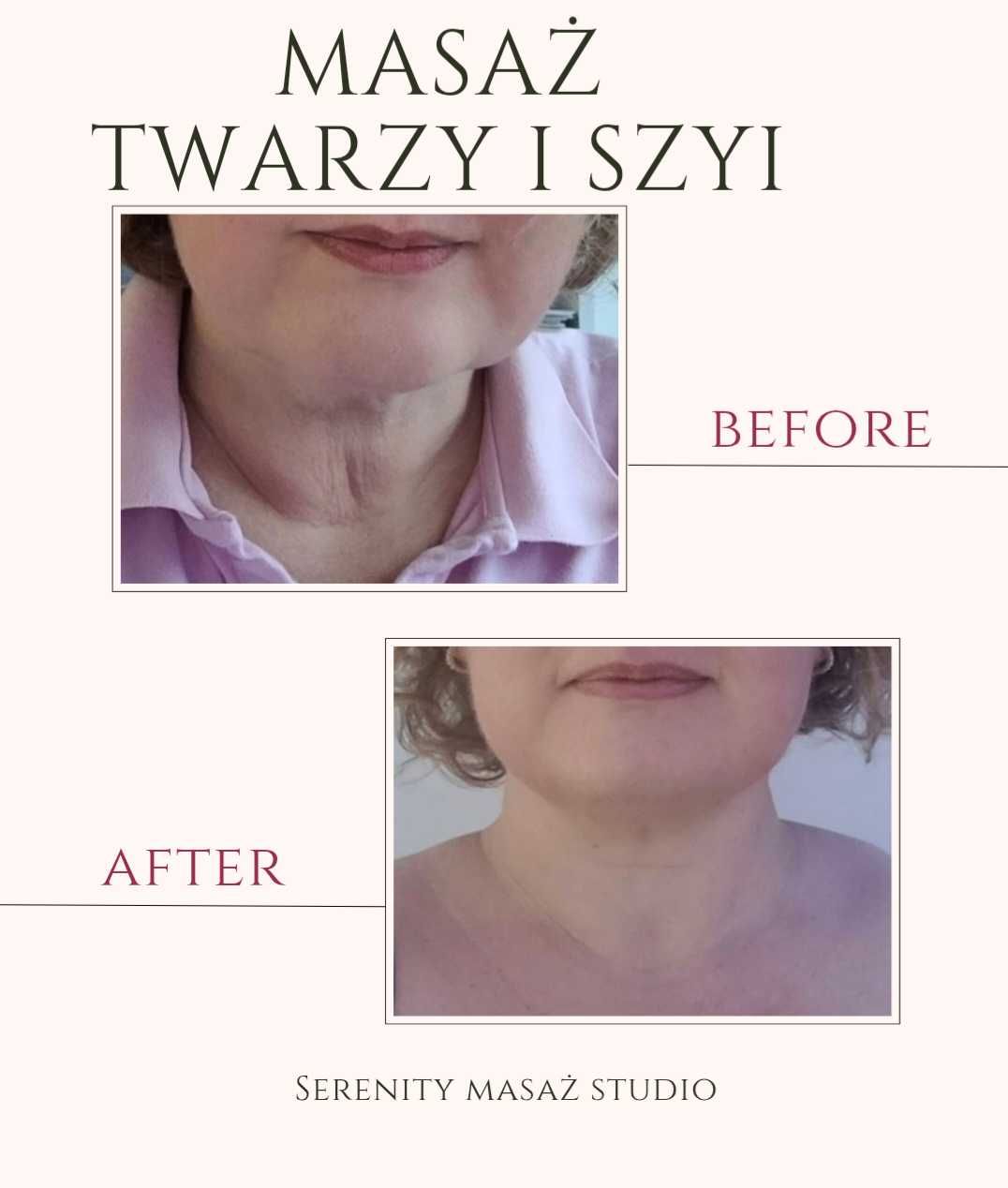 Masaż -leczniczy/sportowy/klasyczny relaksacyjny/antycellulitowy masaż