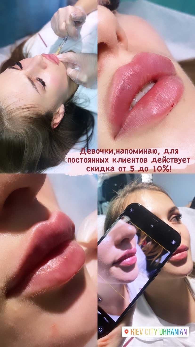 Увеличение губ от 1800 грн. ЭФФЕКТИВНО И НЕДОРОГО!