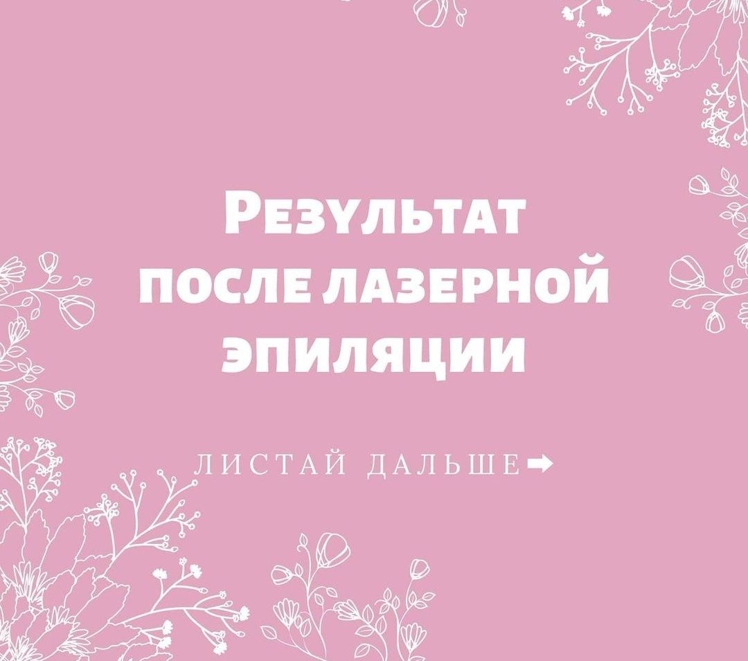 Лазерная эпиляция -50% , двойная система охлаждения, три длинны волны!