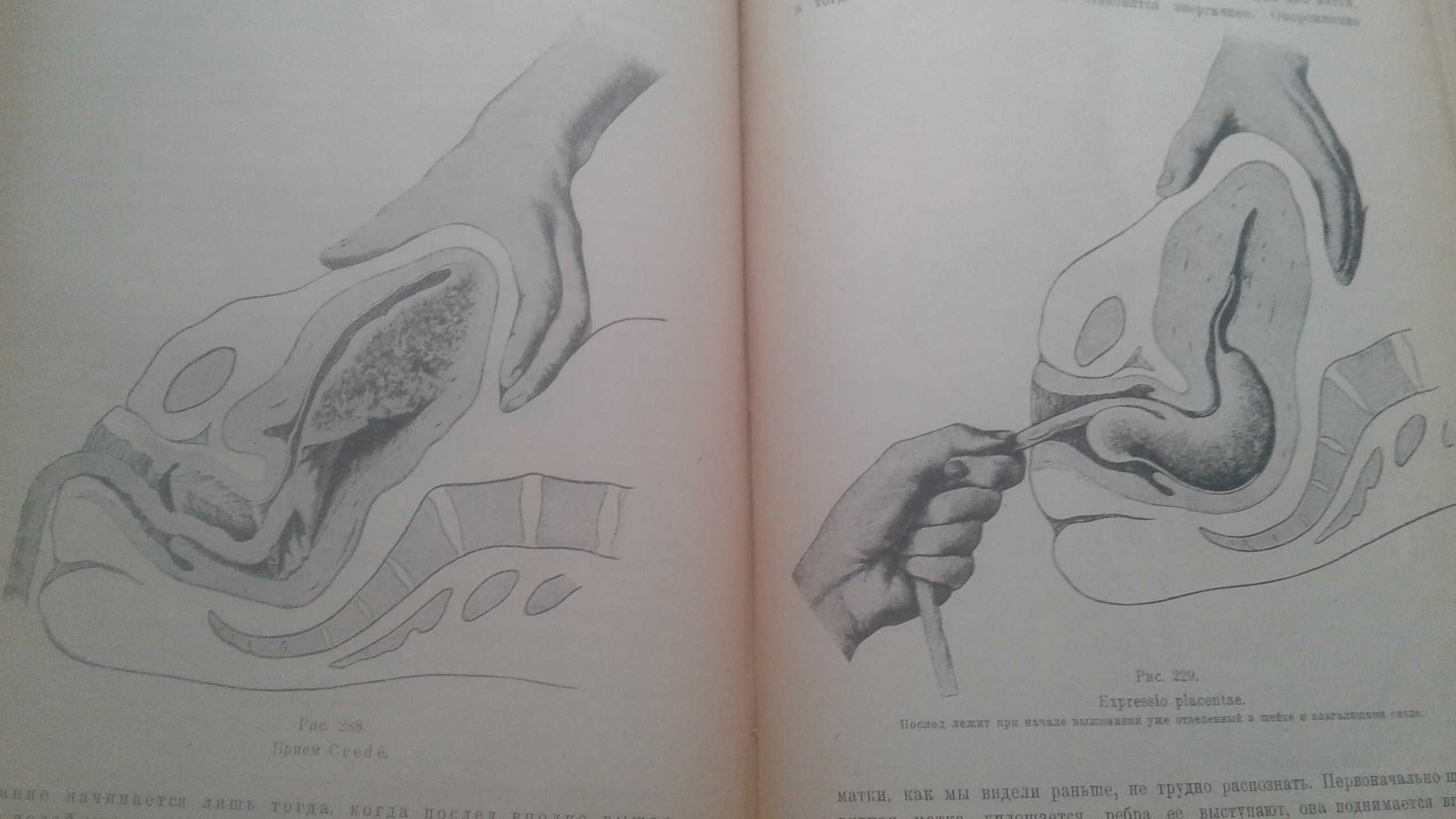 Физиологическое акушерство 1922 год антикварная книга