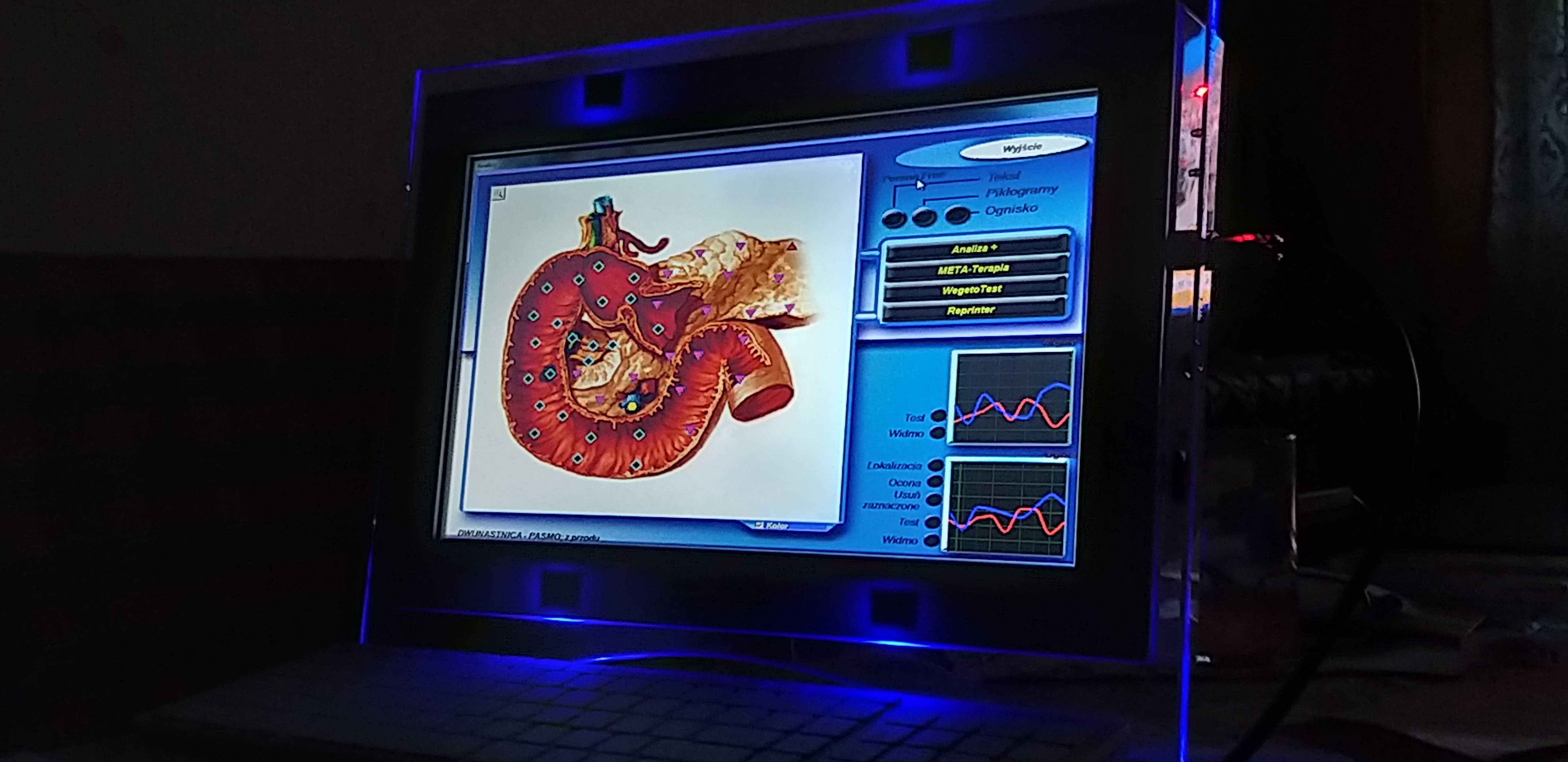 Badanie Biorezonansem-Diagnostyka Skanerem 3D - NEOMED Śląsk