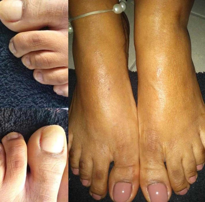 Modelo alongamento unhas