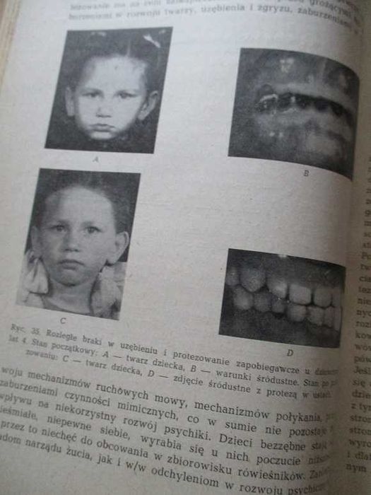 Stomatologia zachowawcza/Zarys stomatologii dziecięcej/stomatologia