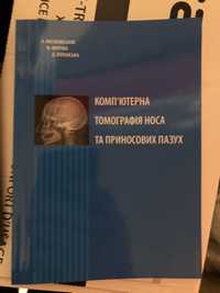 Компютерна томографія носа та приносових пазух