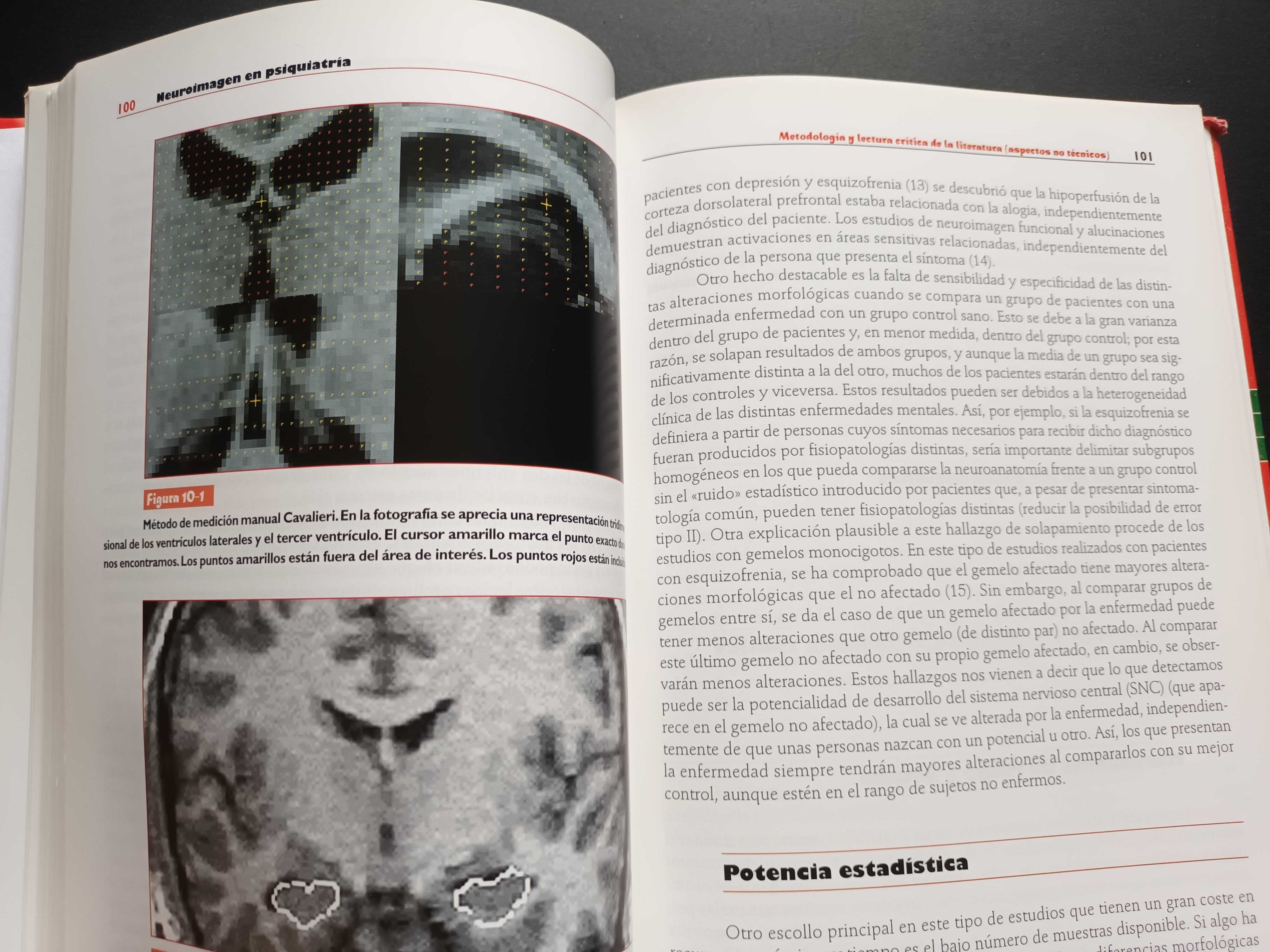 "Neuroimagen en Psiquiatría" por López, Crespo-Facorro e Arroyo