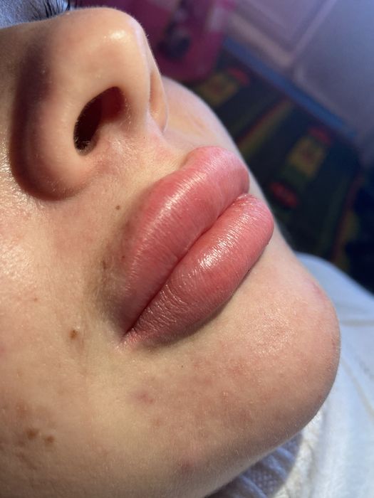 Аугментація обличчя