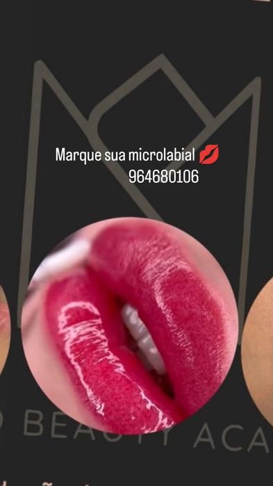 Faço microlabial