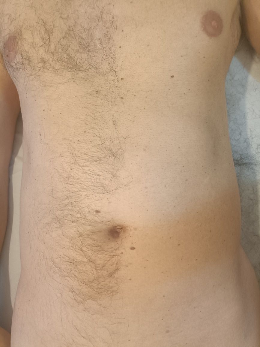 Depilação Masculina