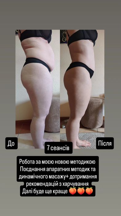 Навчання з масажу