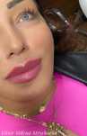 Botox i kwas hialuronowy w Twoim domu