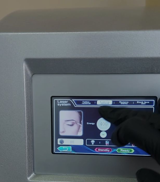 Лазерне видалення тату та ПМ