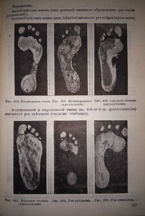 Кервен Хирургическая диагностика 1933