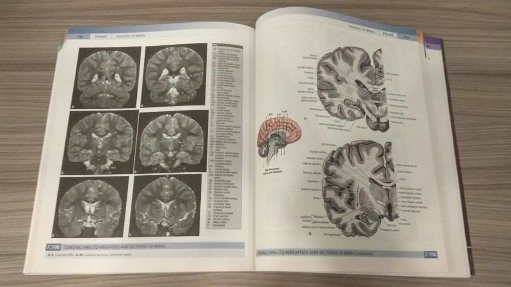 Atlas of Human Anatomy Grant's 14 (Int. Engl.) атлас анатомии человека