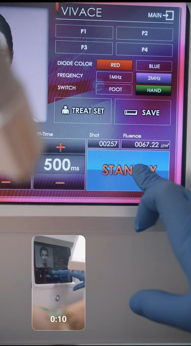 Urządzenie kosmetologiczne Vivace-Sheen B