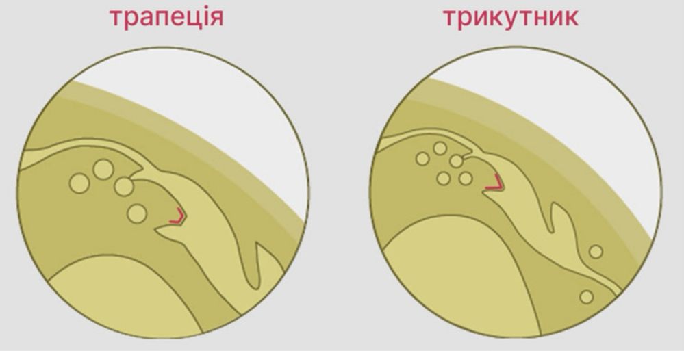 Продам монету рідкісну