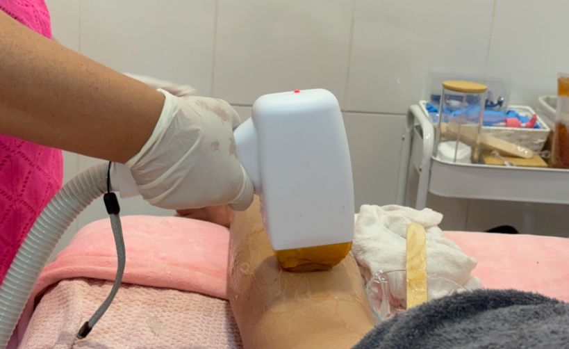 Depilacao a laser , feminino e masculino