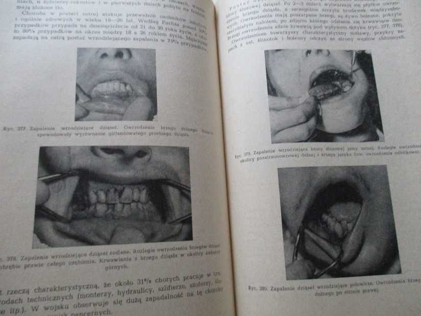 Stomatologia zachowawcza/Zarys stomatologii dziecięcej/stomatologia