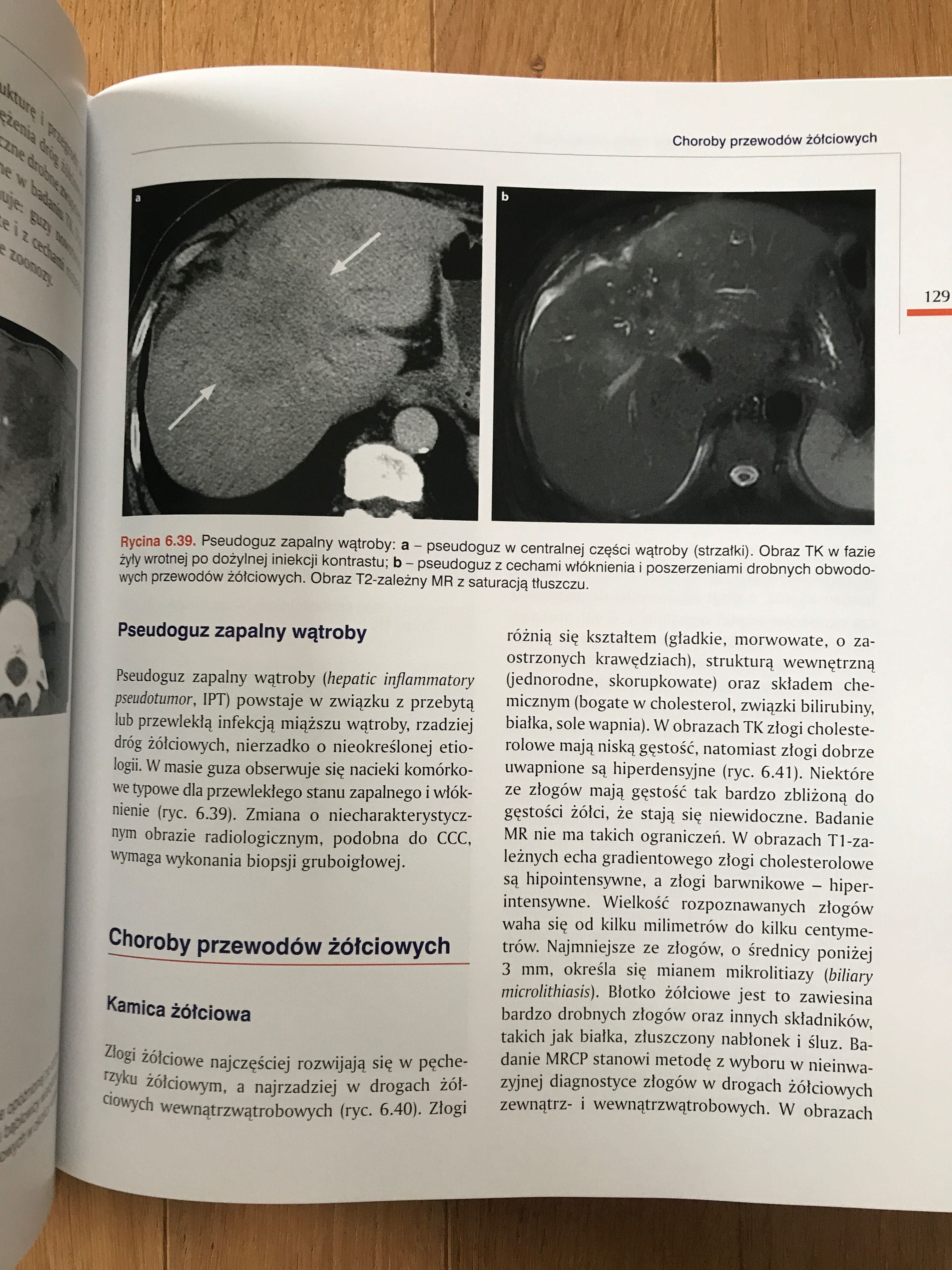 HEPATOLOGIA Tom 1 i 2 - Anatol Panasiuk