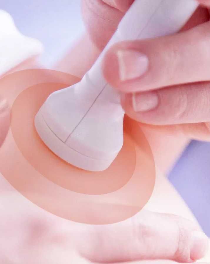 Detektor tętna płodu Baby Sound Detektor tętna płodu Baby Sound