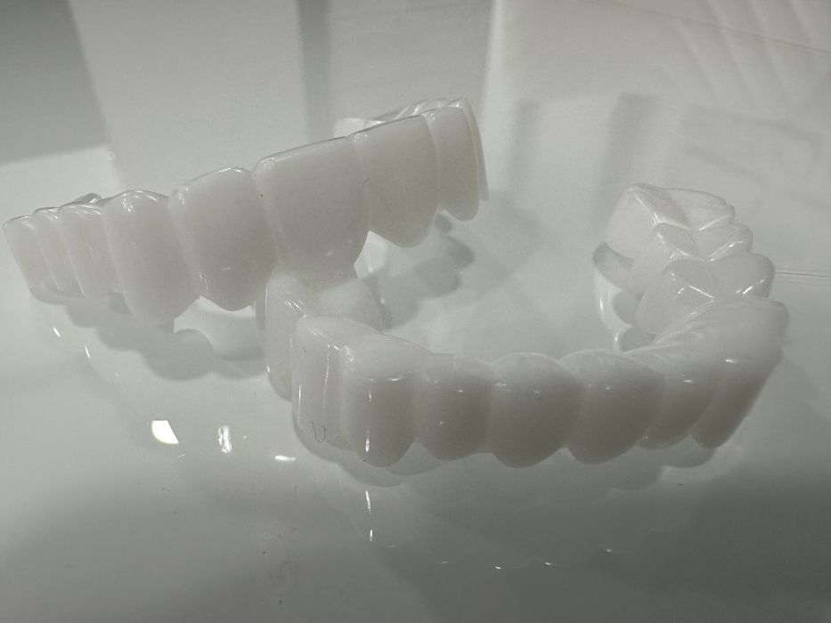 Виниры! Скорая помощь для Вашей красивой улыбки!