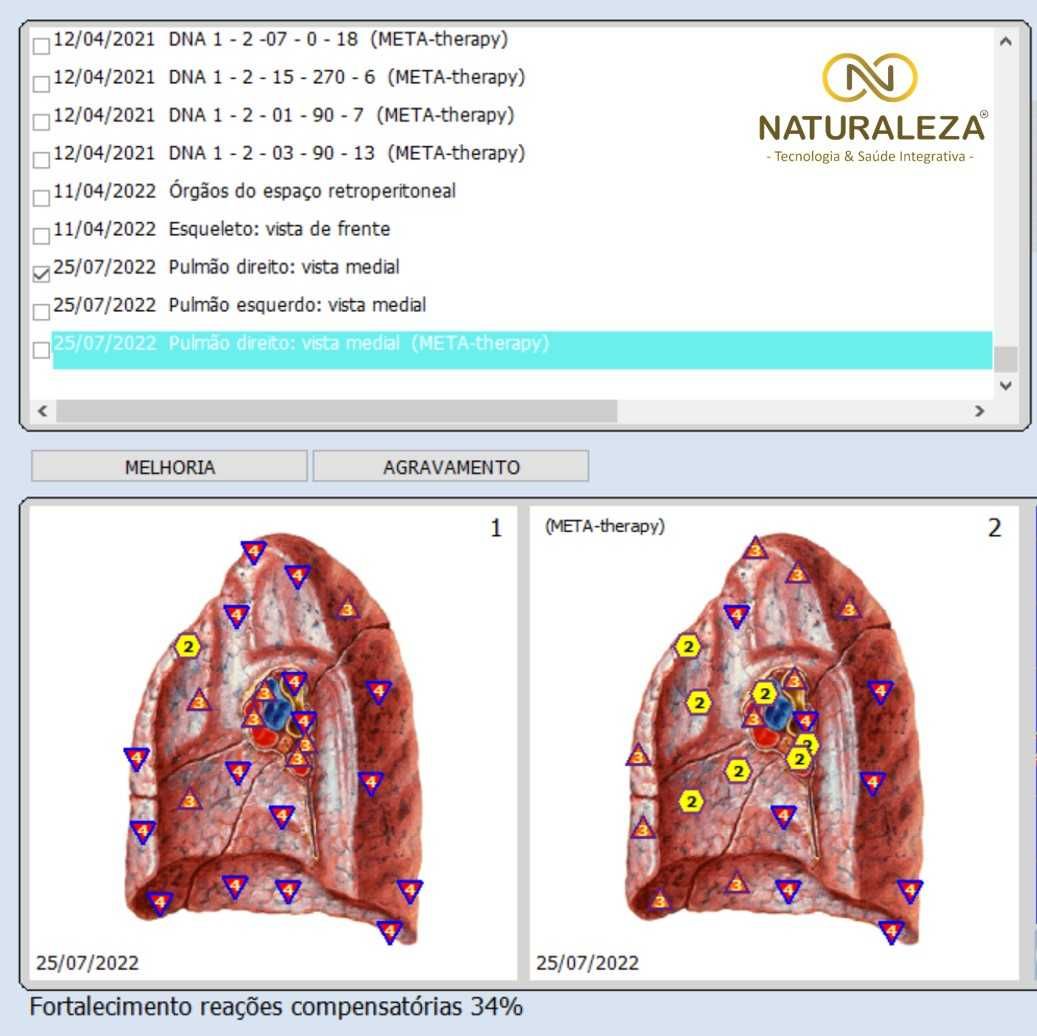 Analisador de Biorressonância e Biofeedback + Oferta mochila brinde