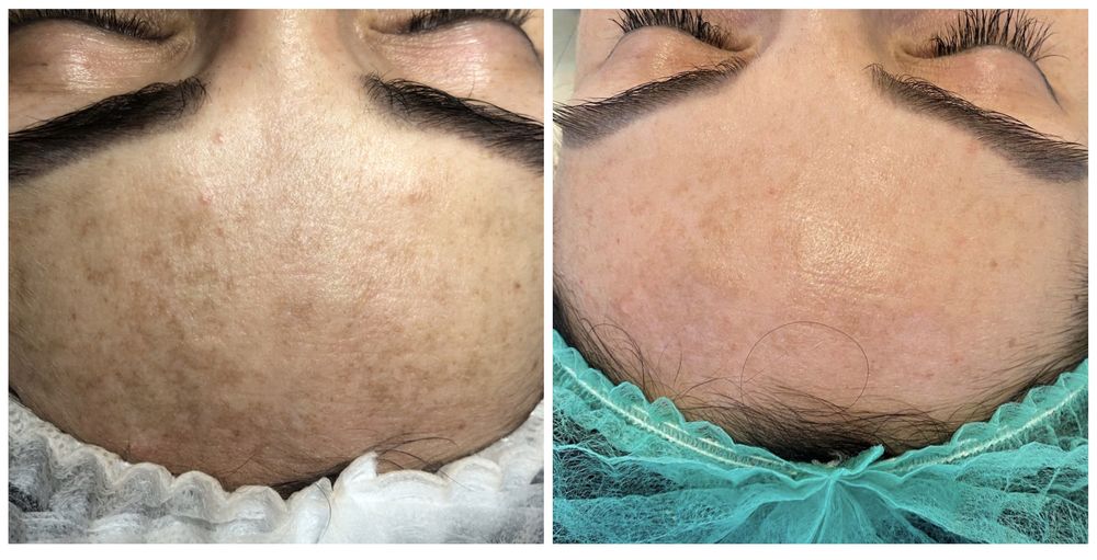 Косметолог Ужгород, інʼєкціоніст.