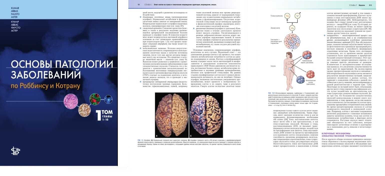 Основы патологии заболеваний по Роббинсу и Котрану В. Кумар - 3 тома
