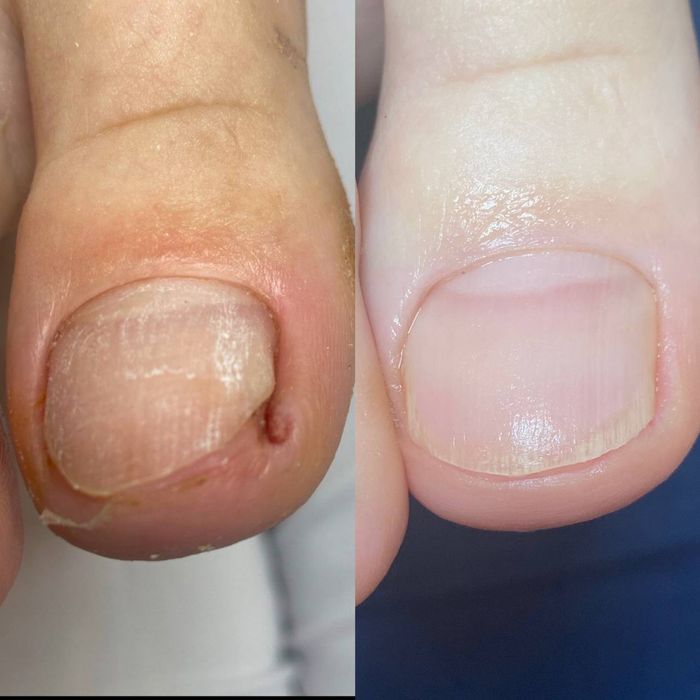 Подолог. Медичний педикюр