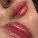 Modelowanie / powiekszanie ust , stymulatory , lipoliza , mezoterapia