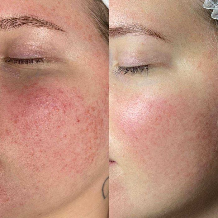 Косметолог дерматолог