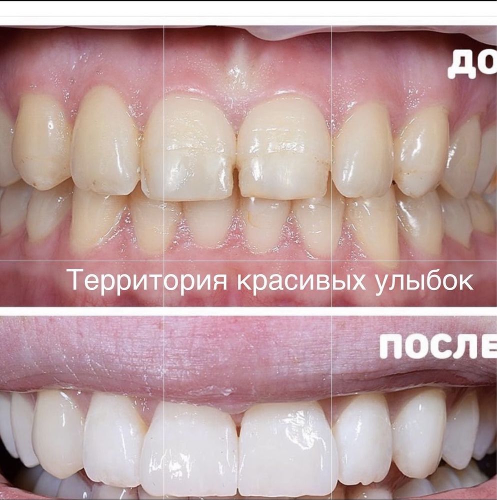 Стоматолог высшей категории. Виниры. Художественная реставрация…