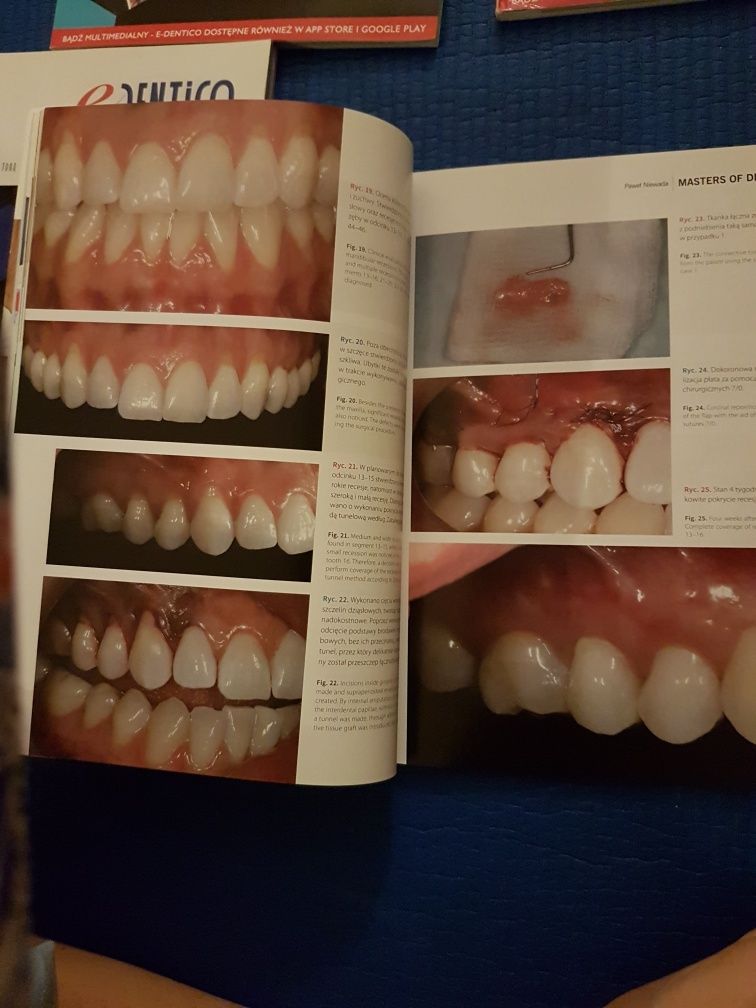 E-dentico  maj czerwiec 3(55)/15 czasopismo stomatologiczne