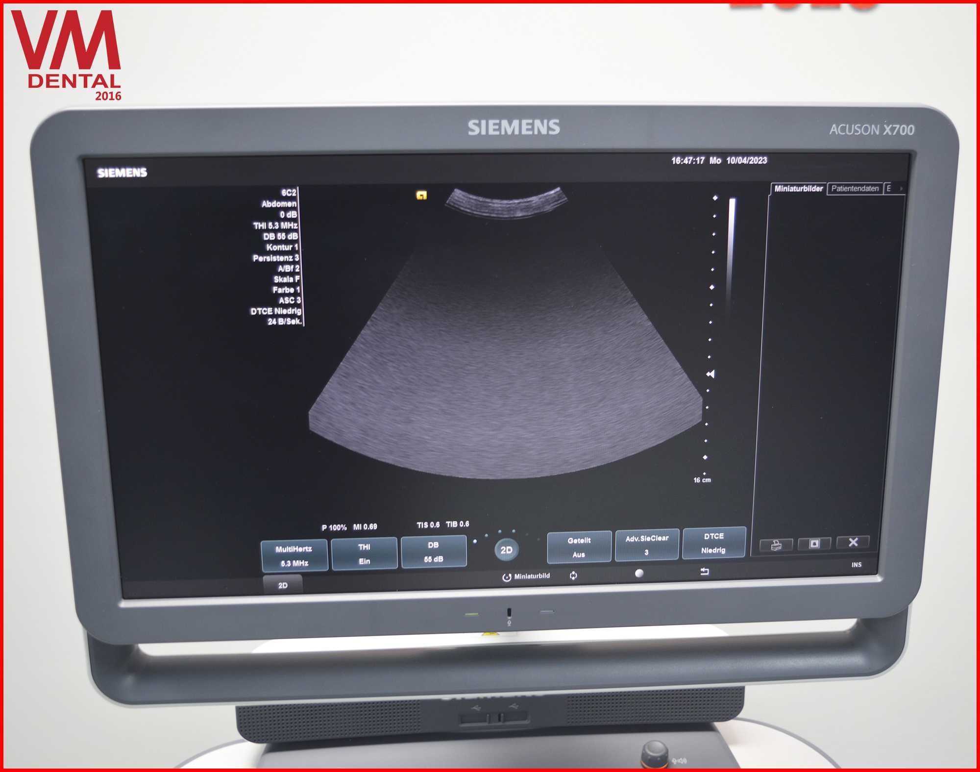 УЗД Апарат Siemens ACUSON X700