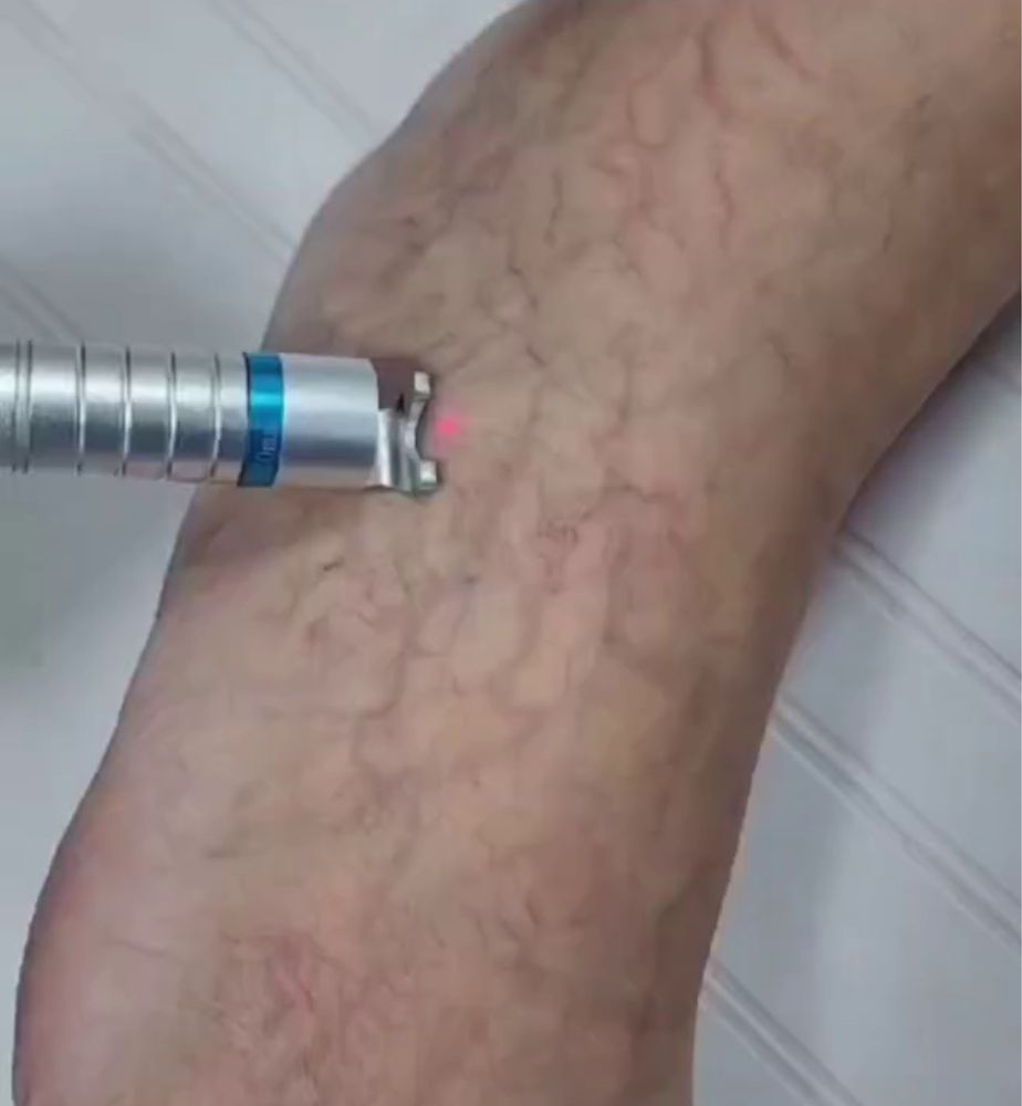Maquina laser pedologia