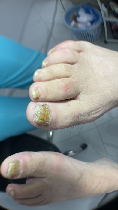 Подолог Мукачево,педикюр Мукачево