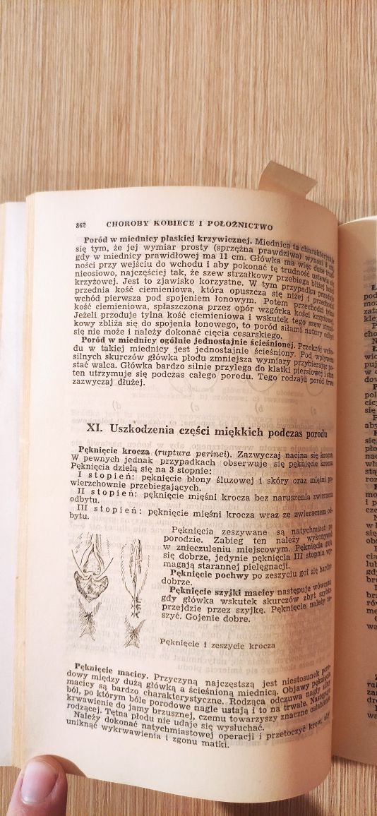 "Mała encyklopedia zdrowia " wydanie IV 1957